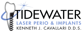 Tidewater Laser Perio & Implants