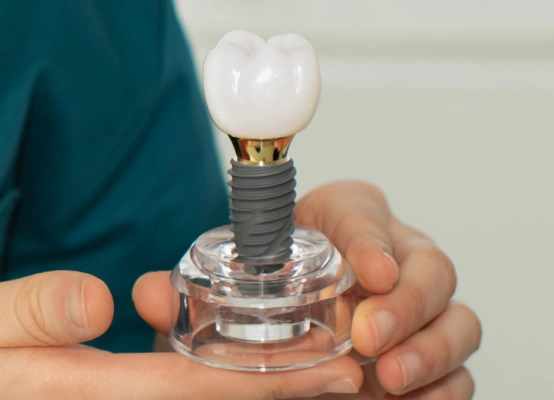 Full mouth dental implants with individual implants for complete restoration