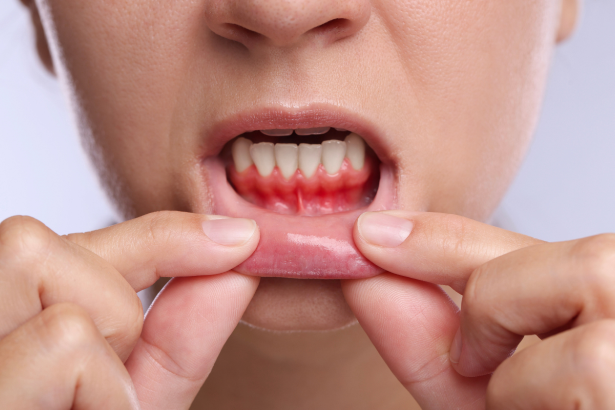 Periodontal examination for gum disease treatment in Virginia Beach